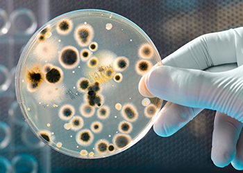 bacteria in petri dish. Credit: Alex Raths, iStock