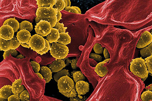 Scanning electron micrograph of methicillin-resistant Staphylococcus aureus bacteria (yellow) and a dead human white blood cell (red). Credit: NIH Image