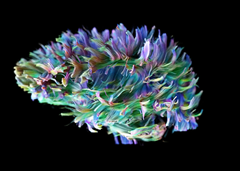 illustration of brain