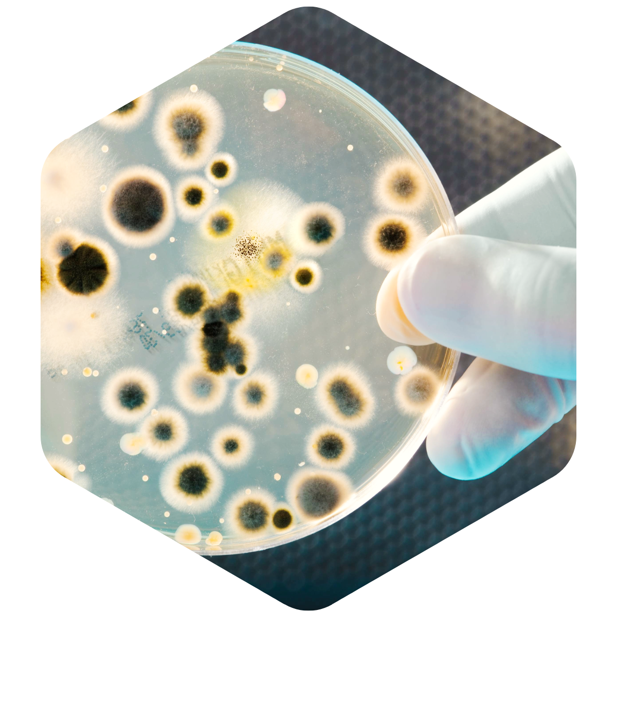 bacteria in petri dish. Credit: Alex Raths, iStock