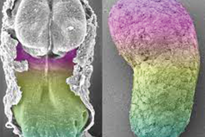 scientific image of human gastruloids