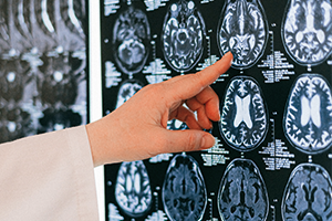 doctor pointing at MRI scan of patient's brain