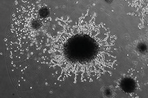 Placental organoid (circle in the centre). Trophoblast cells are invading out of the organoid, mimicking placental cells invading the uterus in the early weeks of pregnancy. Credit: Friedrich Miescher Institute/University of Cambridge Placental organoid. Trophoblast cells are invading out of the organoid, mimicking placental cells invading the uterus in the early weeks of pregnancy. Credit: Friedrich Miescher Institute/University of Cambridge