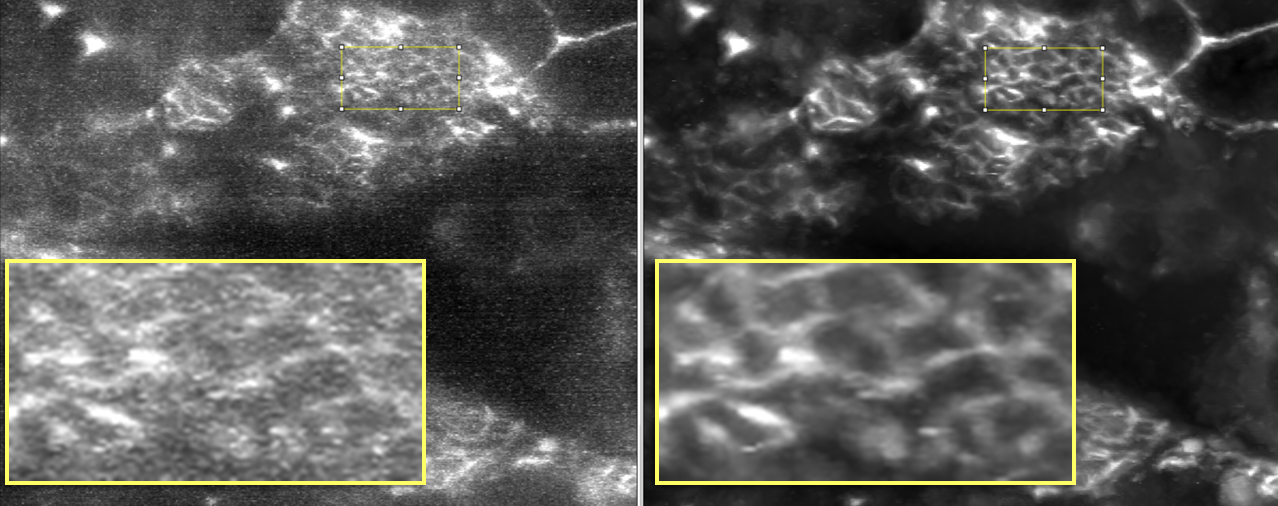 Denoising for large scale images Denoising for large scale images