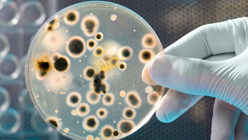 scientist holding petri dish containing bacteria