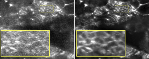Denoising for large scale images 