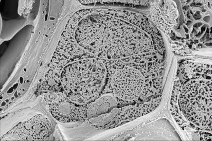 Microscope image of Plantain stem (fractured) showing cell walls and cell interior with various organelles and delineating membranes