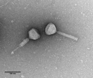 MSPA55 bacteriophages isolated from P. aeruginosa with long tails, which can be seen here in the contracted and non-contracted forms (Maria Stroyakovski, Prof. George PC Salmond group, Biochemistry, Cambridge). 