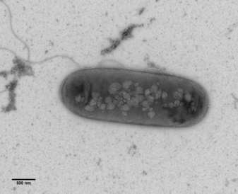 Bacterium with flagellum and gas vesicles (Rita Monson, Prof. George PC Salmond group, Biochemistry, Cambridge). 