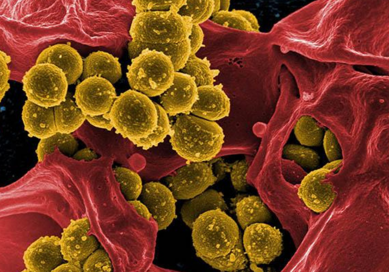 Scanning electron micrograph of bacteria