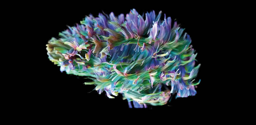 A highly detailed MRI scan of the human brain's white matter fibres Credit: Prof. D. Jones, Cardiff University Brain Research Imaging Centre and Siemens Healthineers