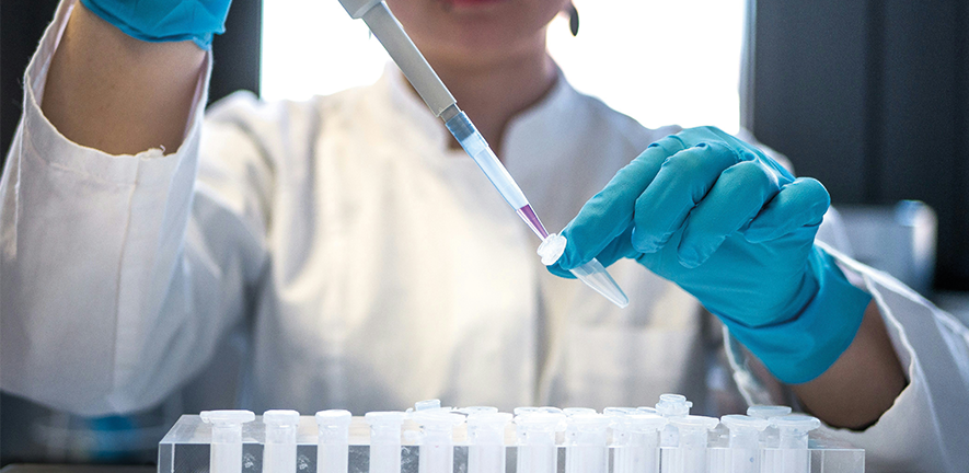 Roving Researcher Scheme A person wearing blue gloves holding a pipette